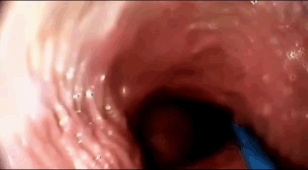 Chaos reccomend camera films orgasm inside vagina