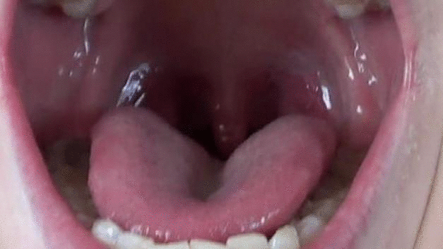 Snickerdoodle reccomend asian girls uvula