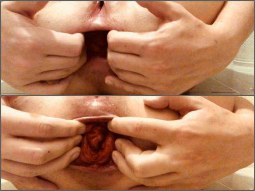 best of Fisting squirting loose prolpase gaping pissing holes